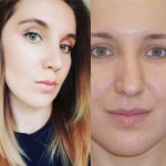 Все отзывы о Положительный отзыв Клиника пластической хирургии New me на stena-otzyvov.ru