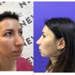 Все отзывы о Положительный отзыв Клиника пластической хирургии New me на stena-otzyvov.ru